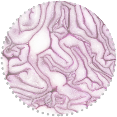 slider-layer1 slider-layer1